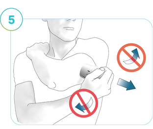 Illustration of Step 5: The direction to remove the applicator from the application site.
