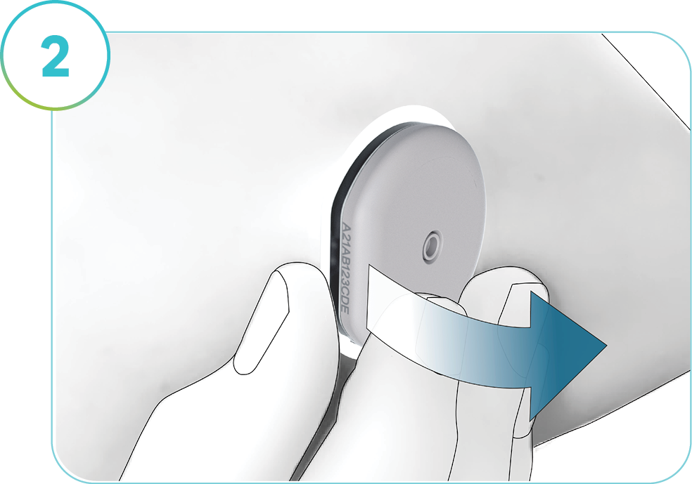 The image depicts how to remove the SmartGuide sensor.