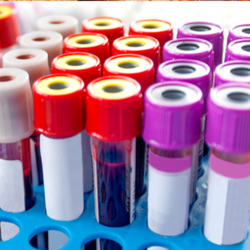 Vials of blood for laboratory testing