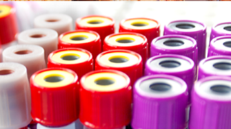 Vials of blood for laboratory testing