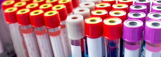 Vials of blood for laboratory testing